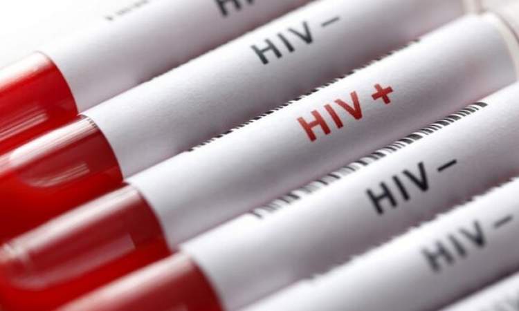 آغاز پویش «من هم تست HIV می‌دهم» از امروز تا ۲۰ آذرماه