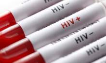آغاز پویش «من هم تست HIV می‌دهم» از امروز تا ۲۰ آذرماه